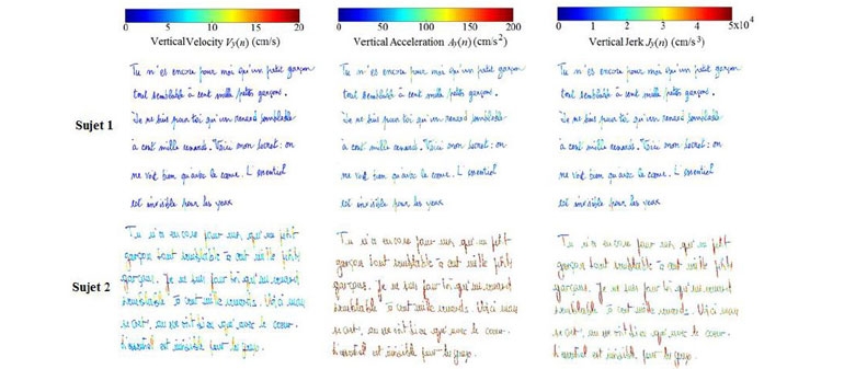 exemple écriture avec signes de maladie neuro-dégénérative